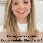 Consigo saber como ficará minha Rinoplastia?